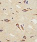 CB2 Antibody (C-term)